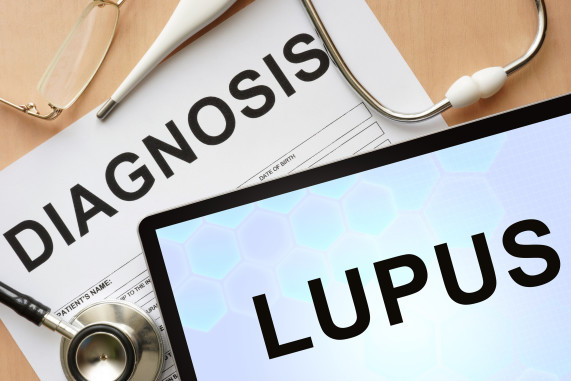 Tablet with diagnosis lupus and stethoscope.