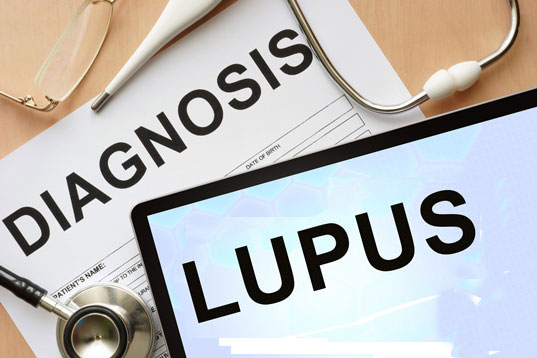 lupus